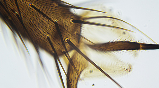 Analyse des parasites