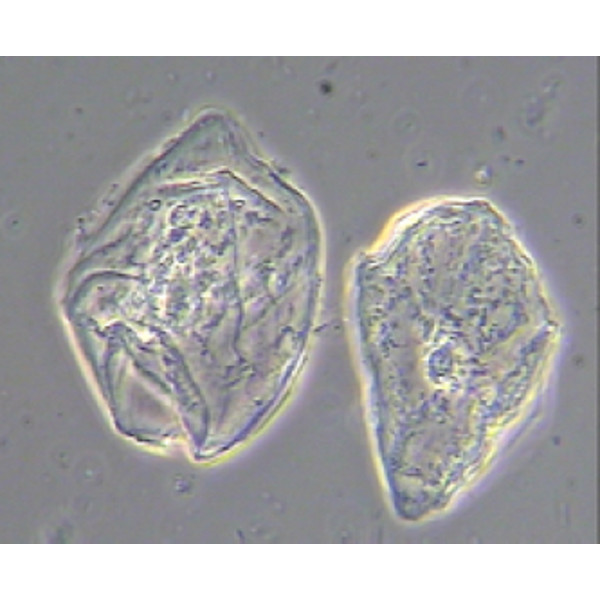 Microscope Hund Medicus plus PH, bino, plan, 100x - 1000x