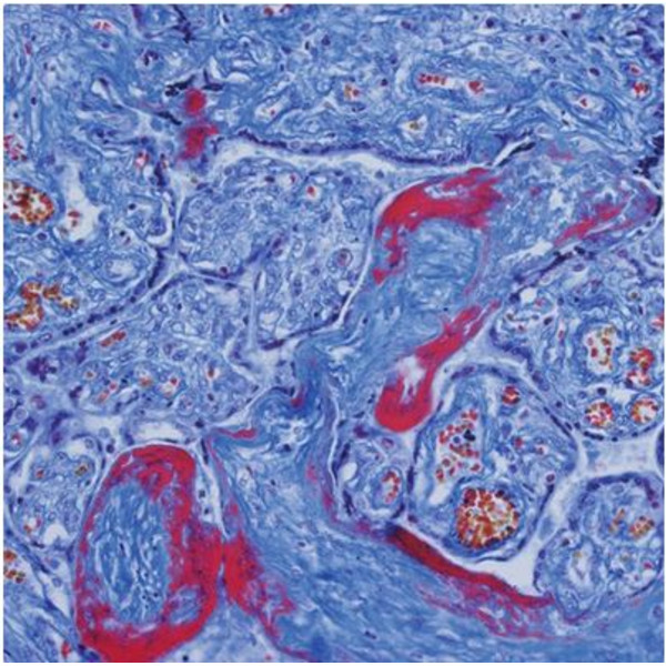 Microscope Evident Olympus CX41 pathologie, trino, Hal, 40x, 100x, 400x