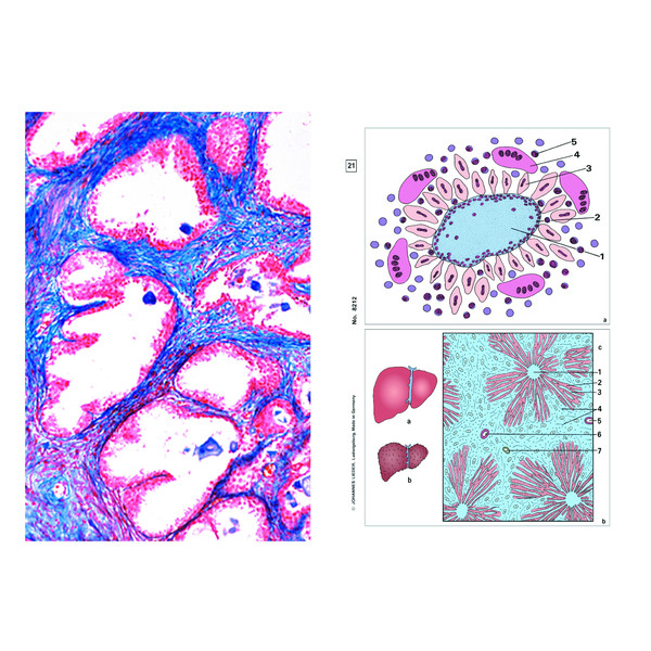 LIEDER Maladies de l'homme (pathologie), base (6 préparations), kit étudiant