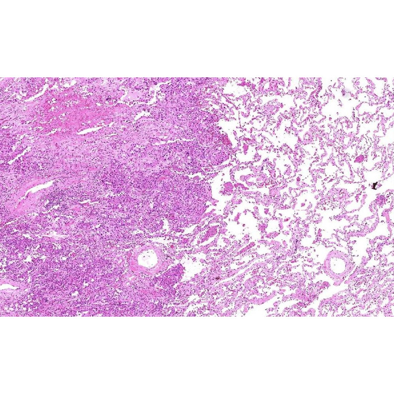 Caméra Lumenera INFINITY2-2C, CCD, color, 2.0 MP