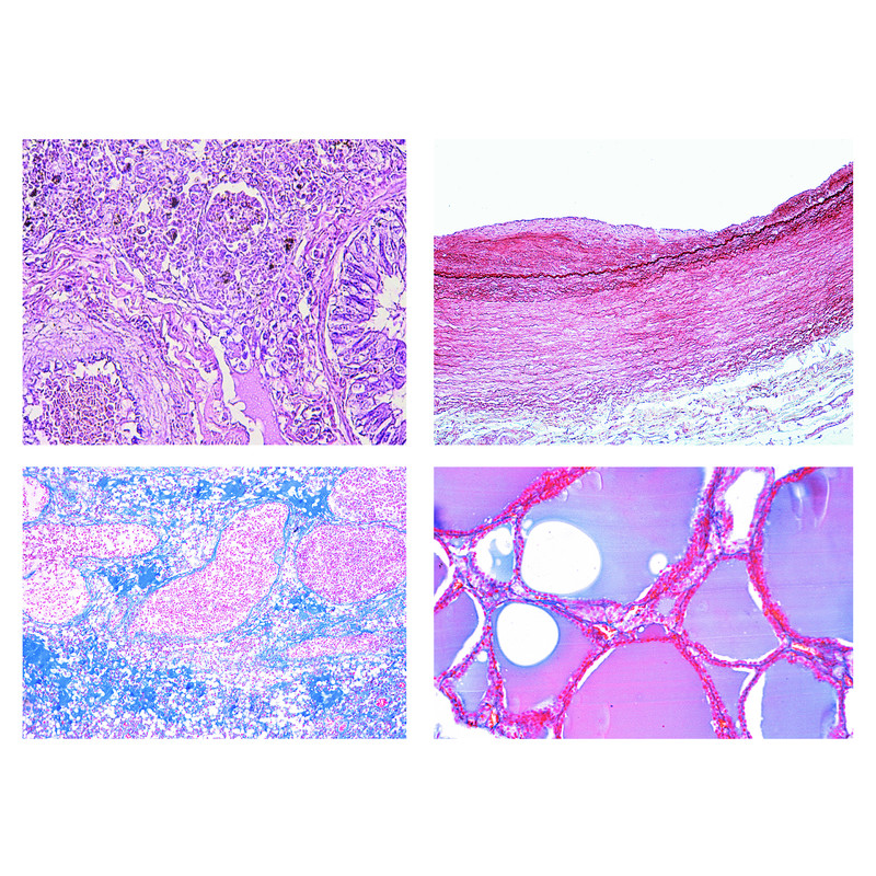 LIEDER Histologie pathologie humaine, petite série (50 préparations)